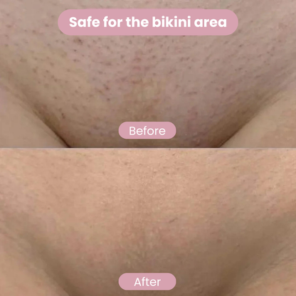 BRILLIION® IPL Hair Removal Luxe