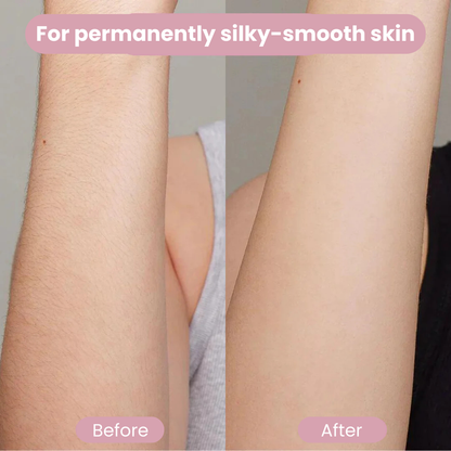 BRILLIION® IPL Hair Removal Luxe