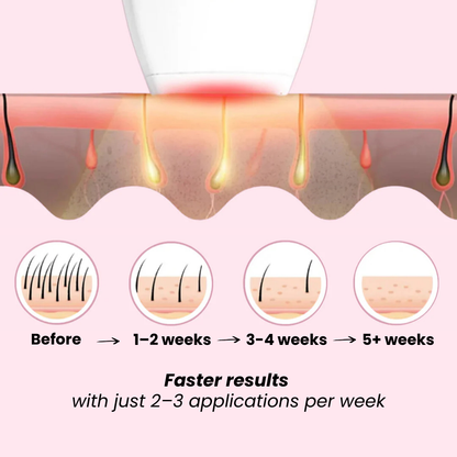 BRILLIION® IPL Hair Removal Luxe