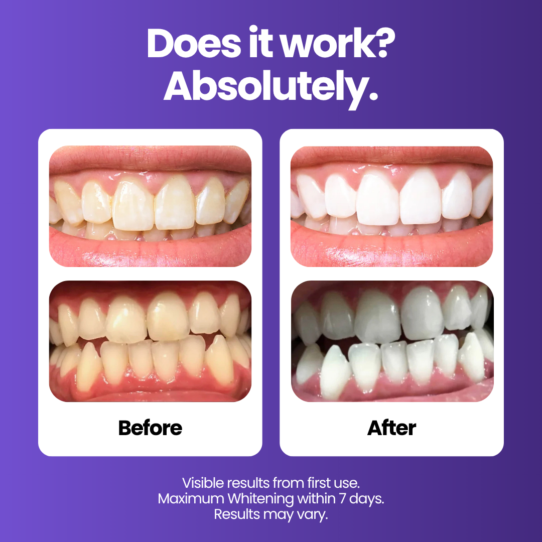 BRILLIION™ Purple Whitening Strips